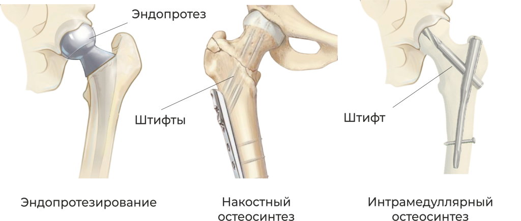 пшб_3.png